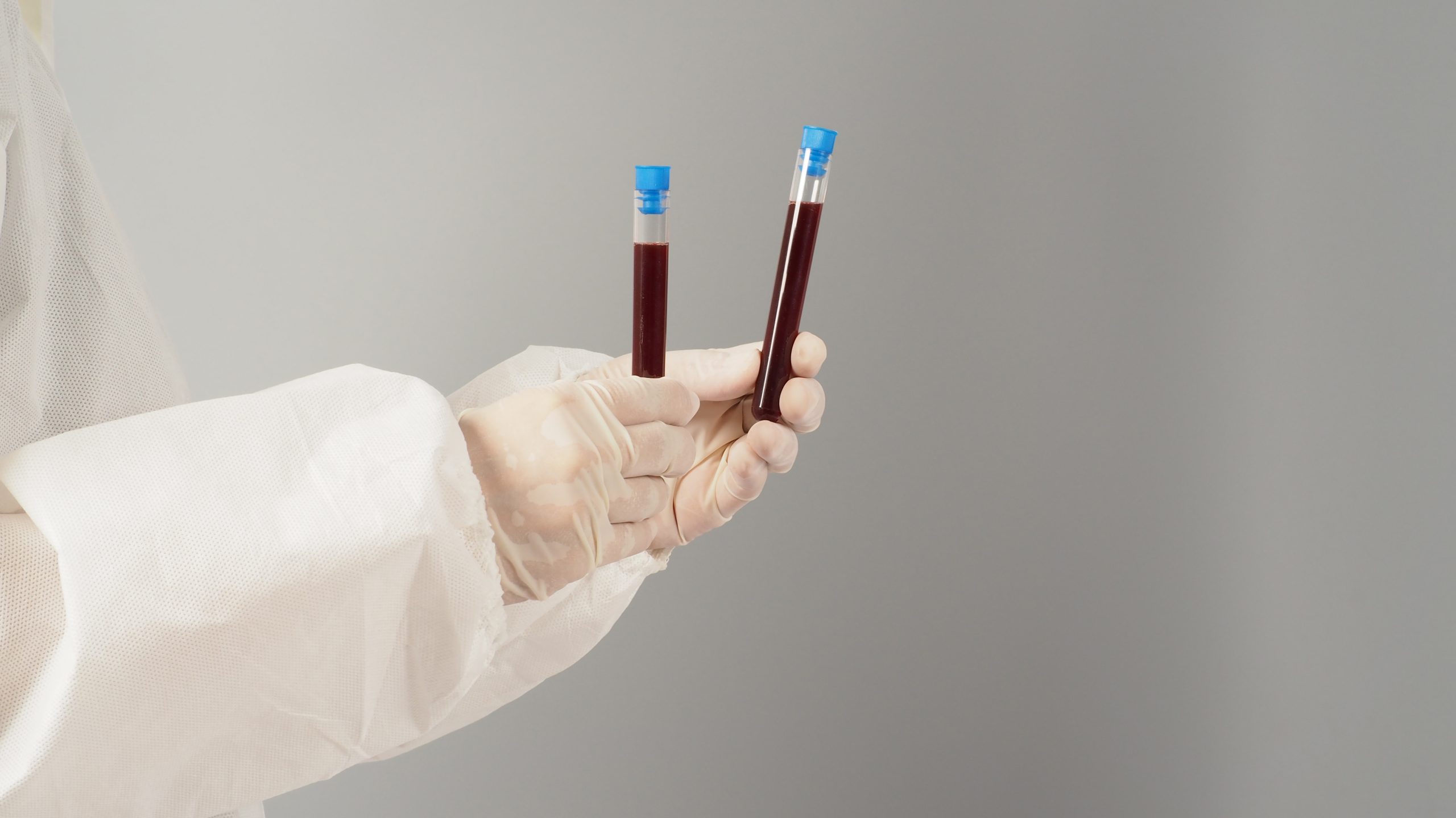 What precautions should we have to determine the coagulation times?