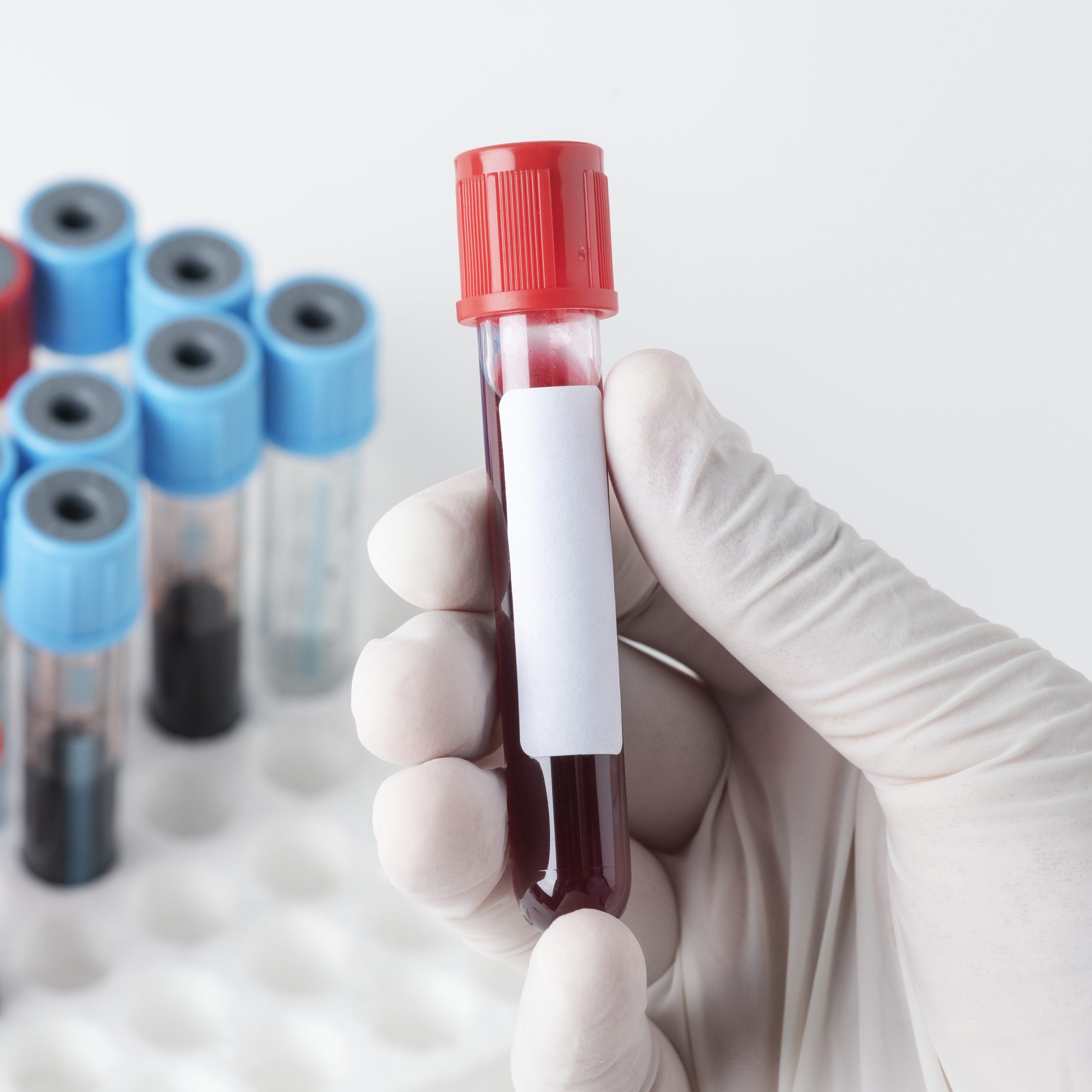 Do you know what the clinical utility of blood tubes is?