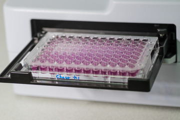 Elisa washing machine to detect Human Lymphotropic Virus infection