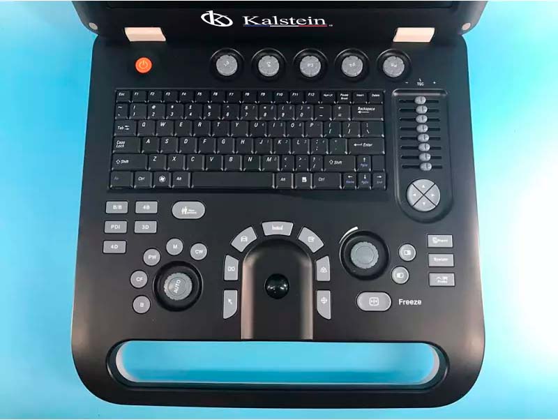 Discovering Excellence in Medical Imaging: The Innovative World of Kalstein Ultrasound Scanners