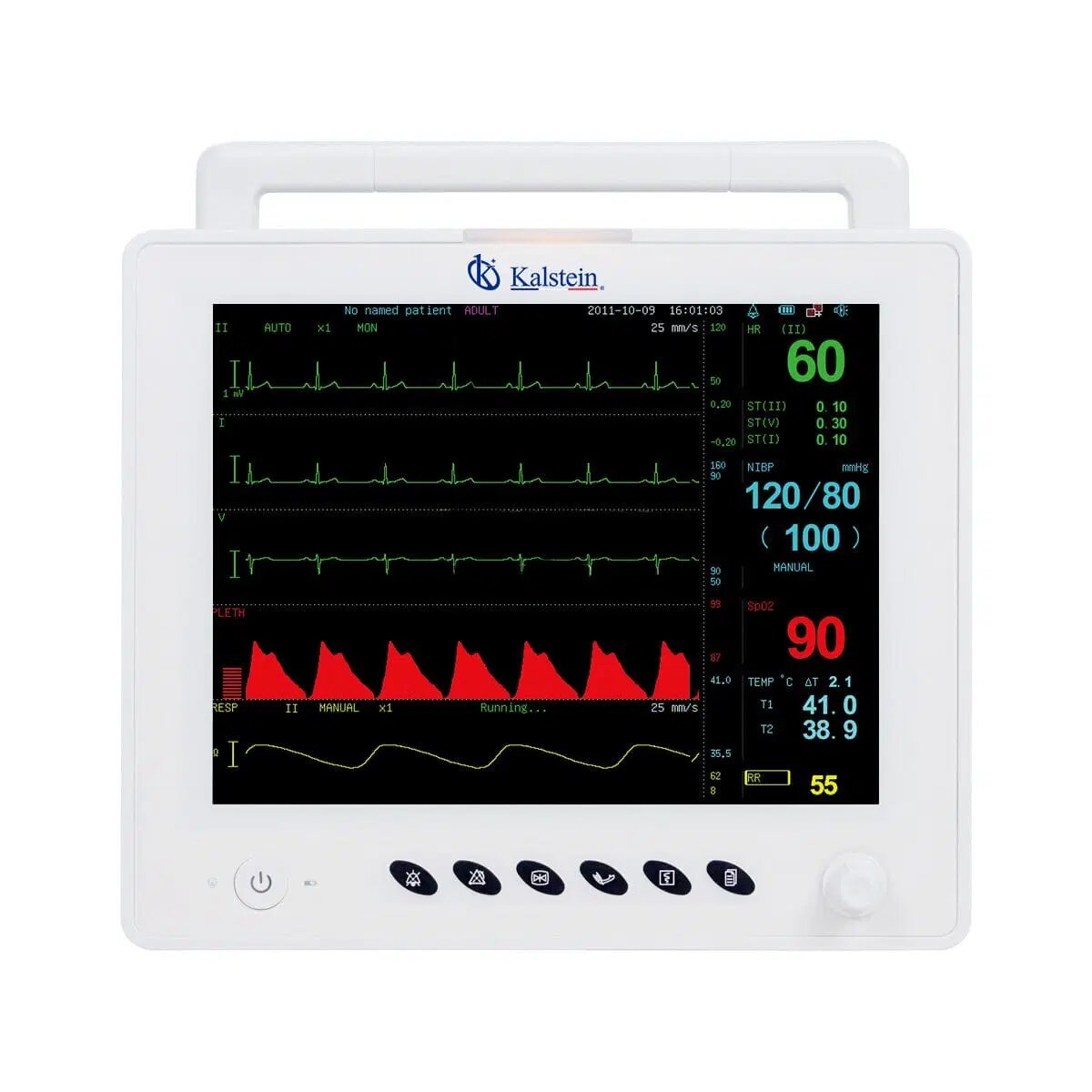 The Ultimate Guide to Veterinary Monitors: Understanding the Kalstein Advantage